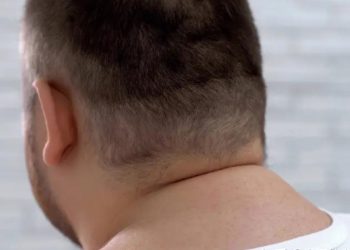How To Get Rid Of Neck Hump