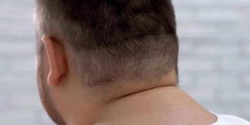 How To Get Rid Of Neck Hump