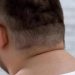 How To Get Rid Of Neck Hump