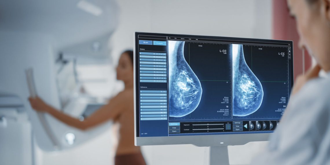 AI breast screening integration