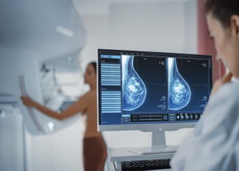 AI breast screening integration