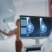 AI breast screening integration