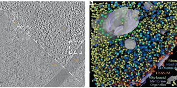 AI Organelle Segmentation