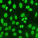Nuclera antibody screening